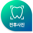 전후사진